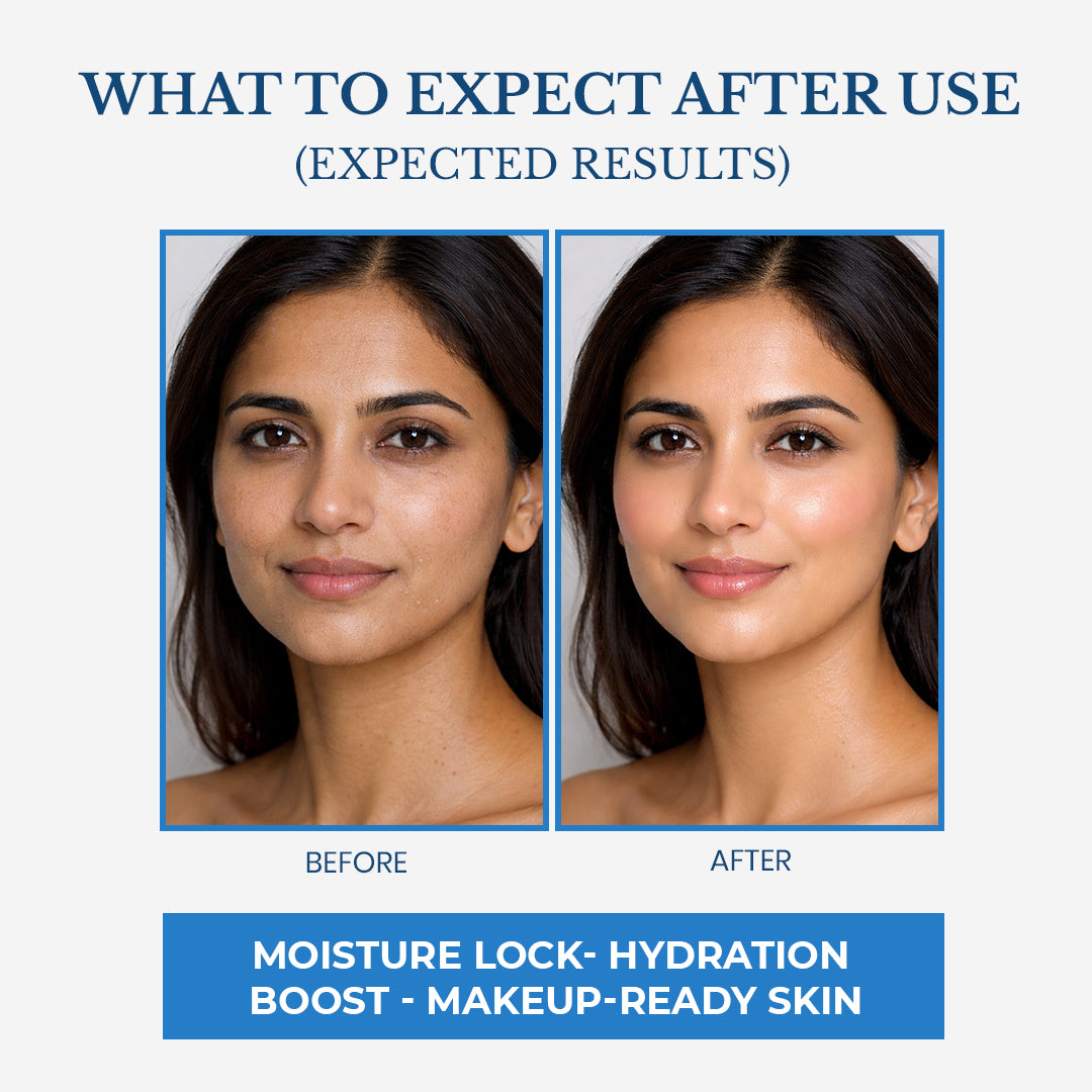 Aqua Restoration Hydrating Moisturizing Cream - Shea Butter, Vitamin-E & Patchouli oil